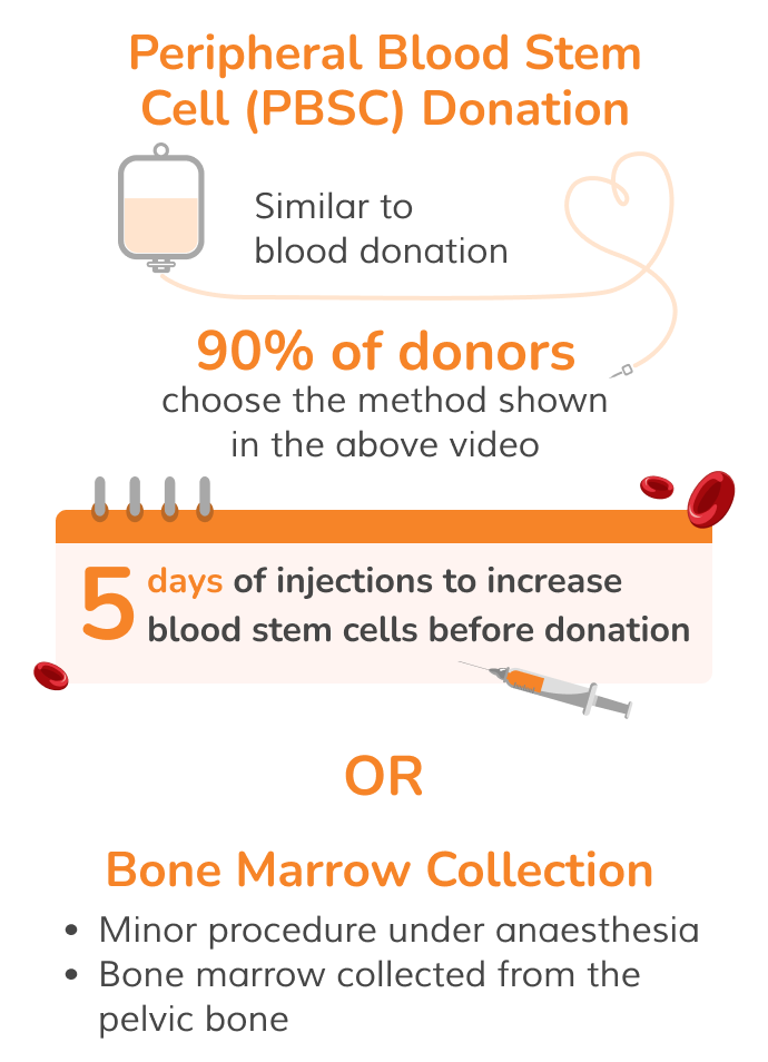 PBSC donation is similar to blood donation. 90% of donors choose this method, after 5 days of injections to increase blood stem cells before donation. The alternative, Bone Marrow Collection, is a minor procedure under anaesthesia in which bone marrow is collected from the pelvic bone.